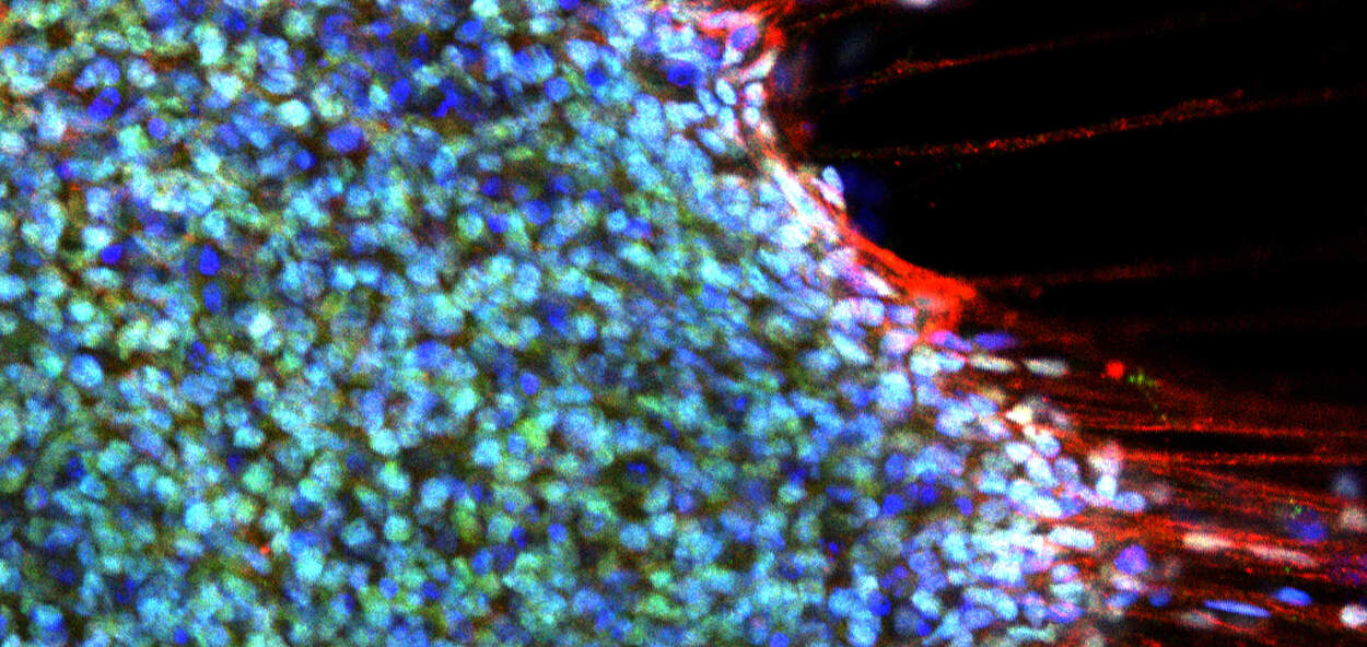 Research Fluorescent microscopy image showing a dense cluster of cells stained in shades of blue and green